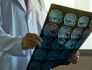 Doctor holding brain MRI in medical office