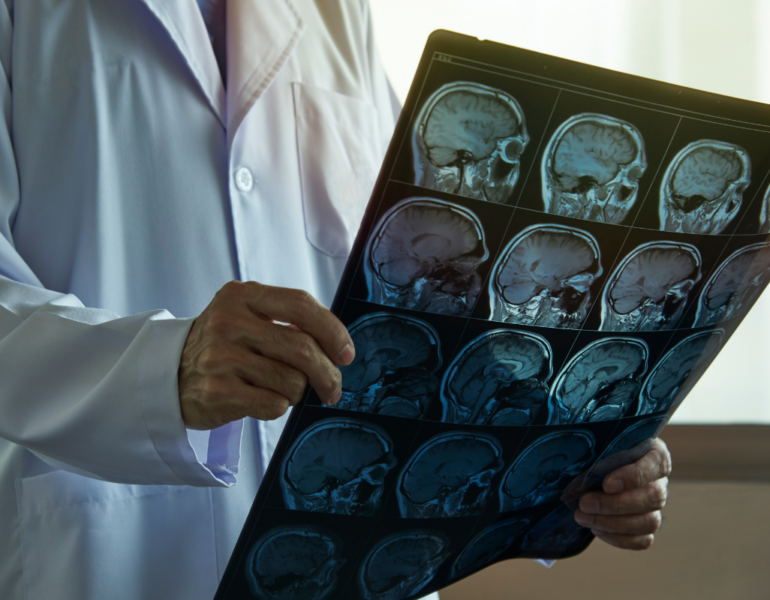 Doctor holding brain MRI in medical office